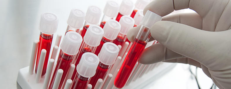 Image of a scientist’s hand with vials of blood.